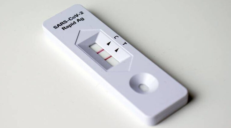 ¿Prueba de orina para detectar Covid?